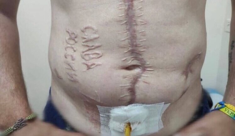 Russians branded words "Glory to Russia" into body of captured Ukrainian soldier. PHOTO OF THE DAY