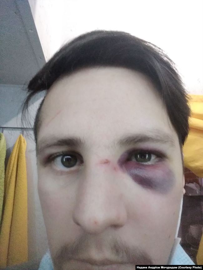 На двух ветеранов во Львове напали полицейские из Черновцов, Ковеля и Бережан 02 На двух ветеранов во Львове напали полицейские из Черновцов, Ковеля и Бережан 02