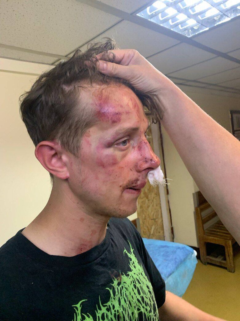 У Києві побили ветерана
