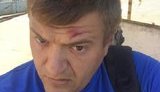 Журналіста Сергія Нікітенка побили в Херсоні. Він пов