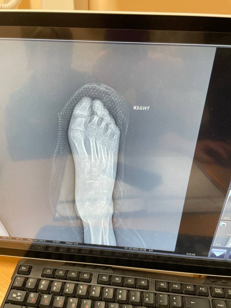 Військовий третьої штурмової бригади Алік