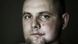 "Я попрощався з життям. Коли прийшов лікар, я спитав у нього, чи я вже на тому світі?" - важкопоранений боєць 80 бригади Андрій Усач