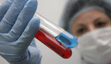 В июле в Украине официально зарегистрированы 1 426 новых случаев ВИЧ-инфекции, от СПИДа умерли 254 человека, - ЦОЗ