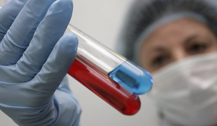 В июле в Украине официально зарегистрированы 1 426 новых случаев ВИЧ-инфекции, от СПИДа умерли 254 человека, - ЦОЗ