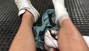 В метро Рима эскалатор сорвался со стопора, пострадали российские футбольные фанаты. ВИДЕО+ФОТОрепортаж