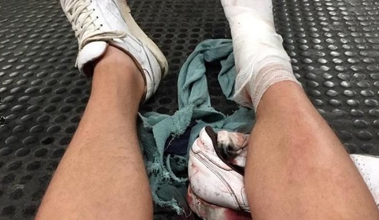 В метро Рима эскалатор сорвался со стопора, пострадали российские футбольные фанаты. ВИДЕО+ФОТОрепортаж