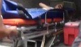 В крымском санатории провалился балкон под детьми. Одна девочка погибла: "Кровь смывали ведрами воды...". ВИДЕО