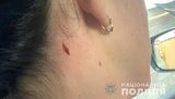 Жінку, що вигулювала собак у районі поліцейського стрільбища в Миколаєві, поранили в шию