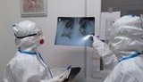 Постковідний синдром - серйозна проблема. Зараз цього не надають глобального значення, - лікарка-пульмонологиня Цімбота