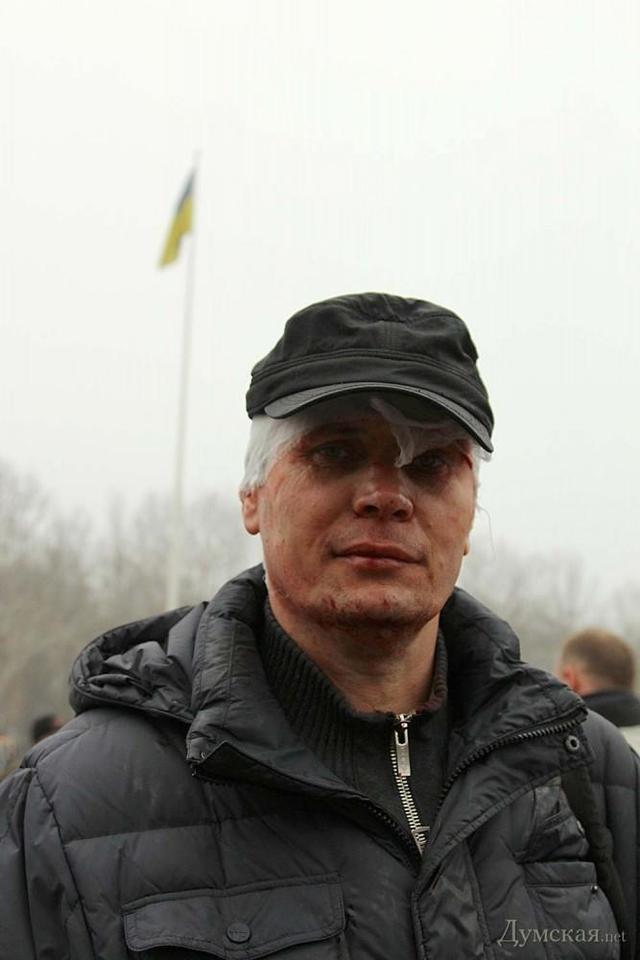 титушки