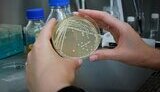 Найстійкіші супербактерії в світі "гартуються" в українських лікарнях