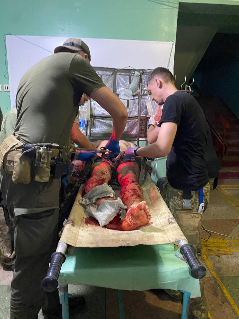 Військовий хірург Дмитро Андрощук, позивний Данте: Одного разу привезли пораненого, біля якого упали і розірвалися три дрони-камікадзе… 06 Військовий хірург Дмитро Андрощук, позивний Данте: Одного разу привезли пораненого, біля якого упали і розірвалися три дрони-камікадзе… 06