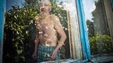 У червні в Україні зафіксували 1542 випадки туберкульозу, - ЦГЗ