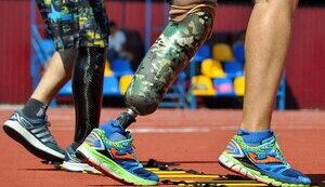 Що робити, якщо ви отримали травму та втратили кінцівки