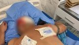 Конфликт между мужчинами на Черкасщине закончился стрельбой - два человека госпитализированы, - Нацполиция. ВИДЕО+ФОТОрепортаж