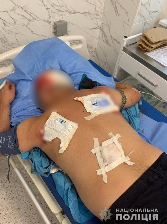 Конфлікт між чоловіками на Черкащині закінчився стріляниною - двох людей госпіталізували, - Нацполіція 02