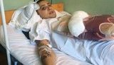 Речові докази у справі нападу на одеських активістів зникли. Проведено службове розслідування, - заступник голови МВС Невгад