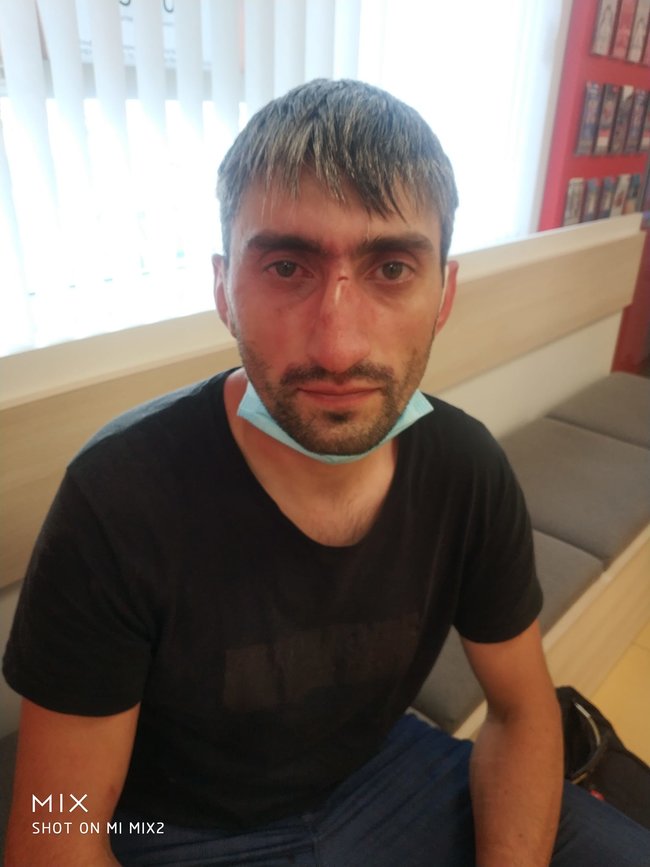 Антимайданівця Топаза побили в Києві 01