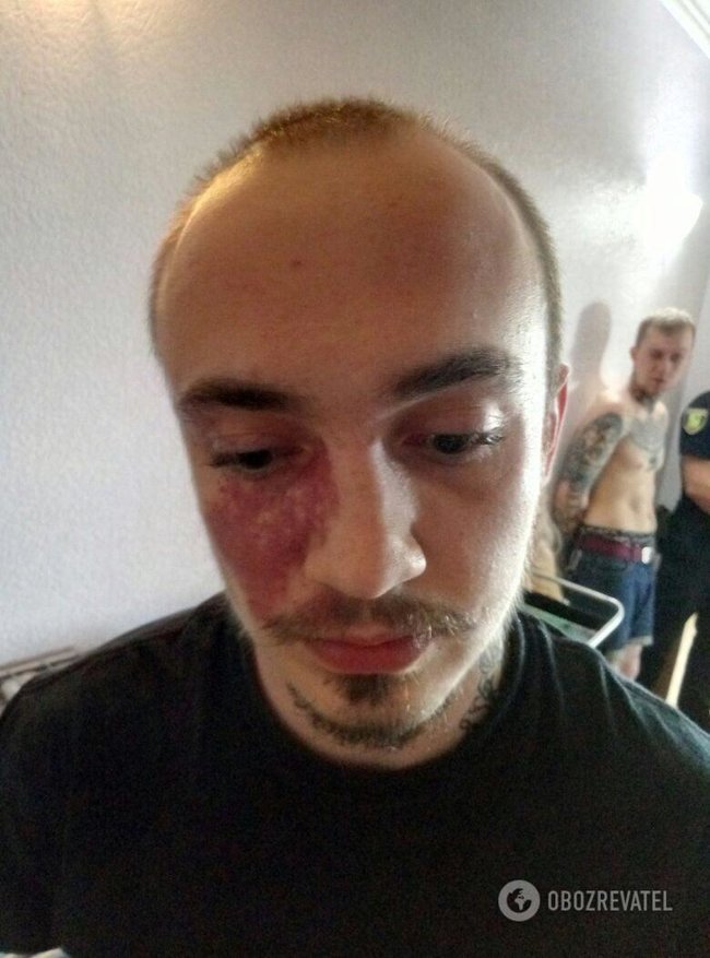 Хотели наказать бандеровца: нападавшие на киборга Вербича задержаны в Харькове 03 Хотели наказать бандеровца: нападавшие на киборга Вербича задержаны в Харькове 03