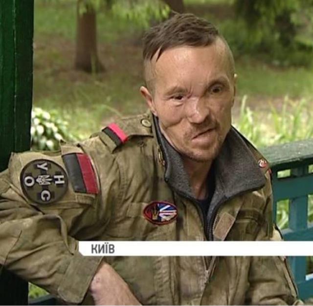 Британець народився в бронежилеті: боєць 93-ї мехбригади Шумейко після важкого поранення мріє повернутися на передову 01 Британець народився в бронежилеті: боєць 93-ї мехбригади Шумейко після важкого поранення мріє повернутися на передову 01