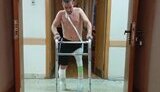 протезування у росії