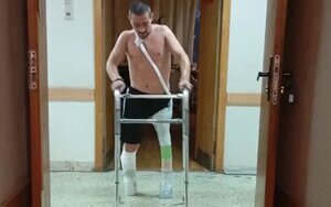 протезування у росії