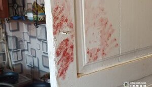 Троє чоловіків побили та пограбували ветерана АТО у Смілі: поліція затримала зловмисників. ФОТОрепортаж