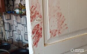 Побиття учасника АТО у Смілі: поліція затримала трьох нападників