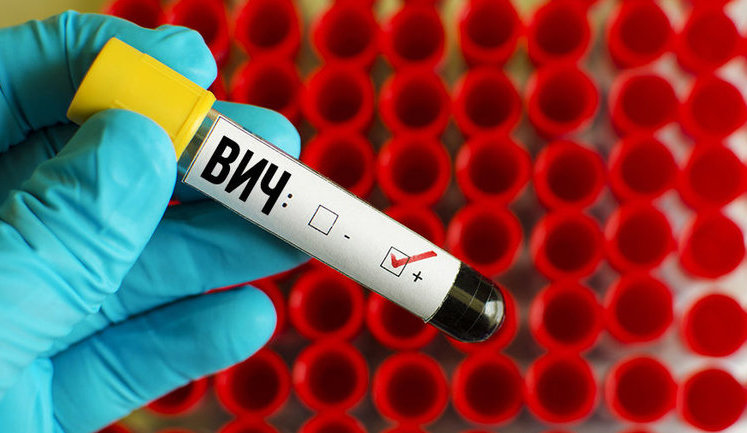 Украина обладает всеми необходимыми ресурсами для преодоления эпидемии ВИЧ/СПИД до 2030 г, - Супрун. ВИДЕО