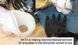 Фонд НАТО почав нову програму в Інституті протезування в Харкові, - Генштаб