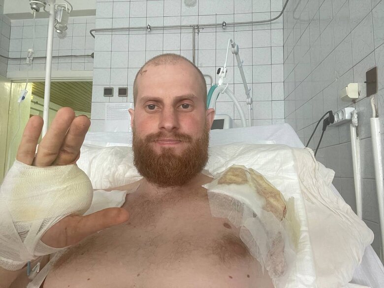 Герой України нацгвардієць Дмитро Фінашин: Свою мертву руку я підкладав під груди, як валик, щоб напитися з тухлої калюжки – не хотілося впасти в неї обличчям і захлинутися 07 Герой України нацгвардієць Дмитро Фінашин: Свою мертву руку я підкладав під груди, як валик, щоб напитися з тухлої калюжки – не хотілося впасти в неї обличчям і захлинутися 07