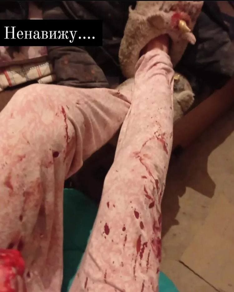Окровавленная, на руках дети, какой-то апокалипсис, - жительница Чернигова, пережившая бомбардировку российской авиацией 05