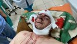 Невідомі напали на ексмера Конотопа Семеніхіна: він у реанімації, - поліція. ФОТО
