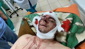 Неизвестные напали на экс-мэра Конотопа Семенихина: он в реанимации, - полиция. ФОТО