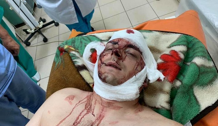 Неизвестные напали на экс-мэра Конотопа Семенихина: он в реанимации, - полиция. ФОТО