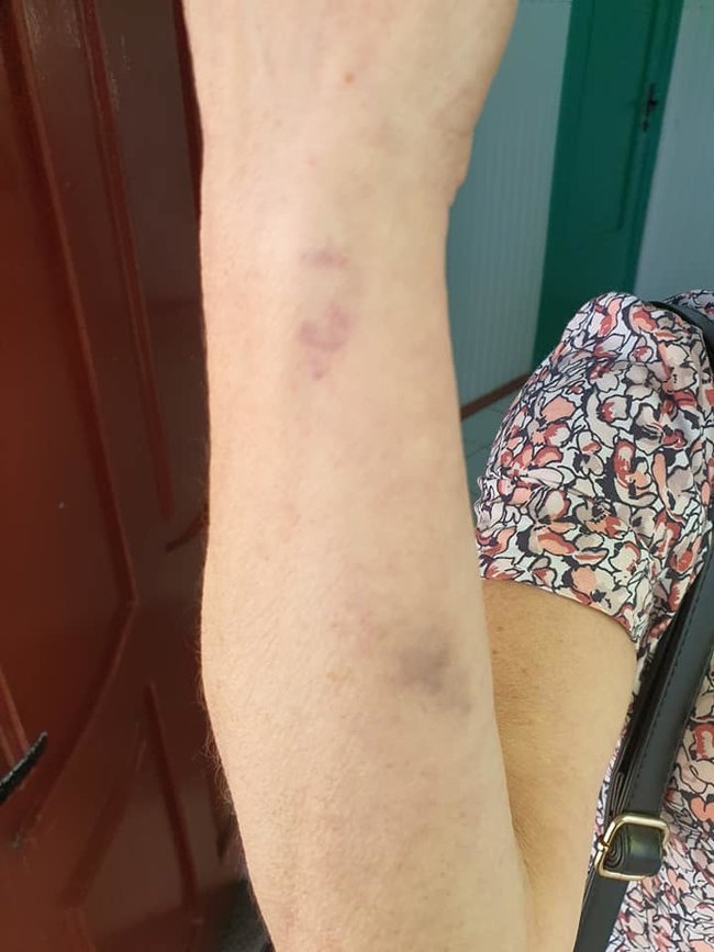 Пяна пасажирка побила кондукторку тролейбуса через прохання одягти маску 02
