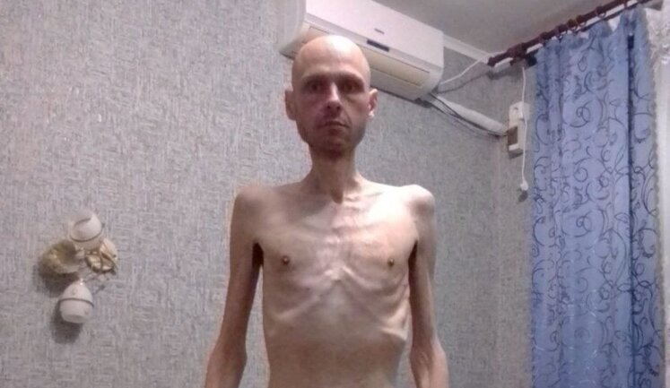 Volodymyr Tsema-Bursov, liberated soldier of 56th Brigade, lost 38 kg in 20 months of captivity and got "bunch" of diseases. PHOTO