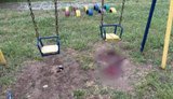 Medical staff have reported on the condition of the injured children following the shelling of Kherson