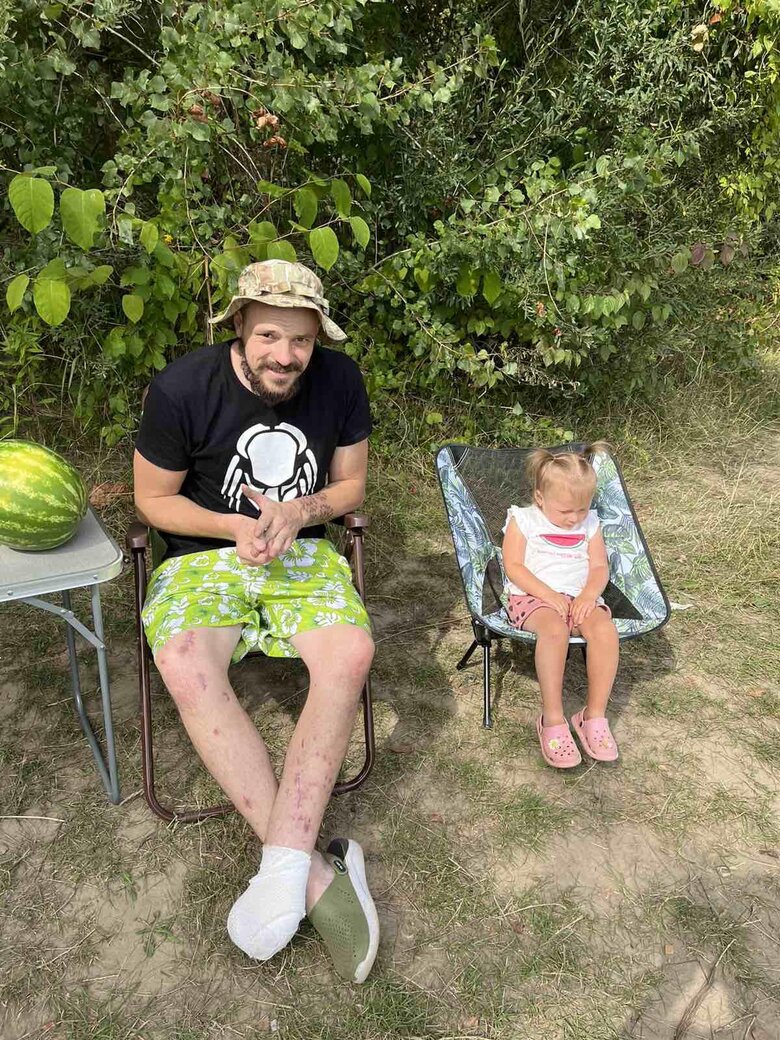 Микола Русецький, позивний Молот: Хочу власним прикладом показувати, що без руки чи ноги все одно можна жити і працювати на захист України 01