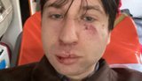 Історика й ветерана Владислава Стародубцева побили перед лекцією у Львові про ліві рухи: поліція розслідує хуліганство. ВІДЕО+ФОТО