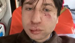 Историка и ветерана Владислава Стародубцева избили во Львове перед лекцией о левых движениях: полиция расследует хулиганство. ВИДЕО+ФОТО