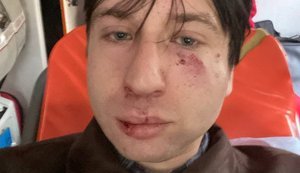 Історика й ветерана Владислава Стародубцева побили перед лекцією у Львові про ліві рухи: поліція розслідує хуліганство. ВІДЕО+ФОТО
