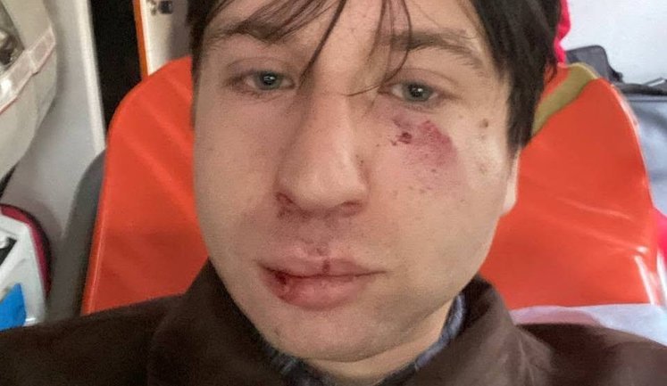 Історика й ветерана Владислава Стародубцева побили перед лекцією у Львові про ліві рухи: поліція розслідує хуліганство. ВІДЕО+ФОТО