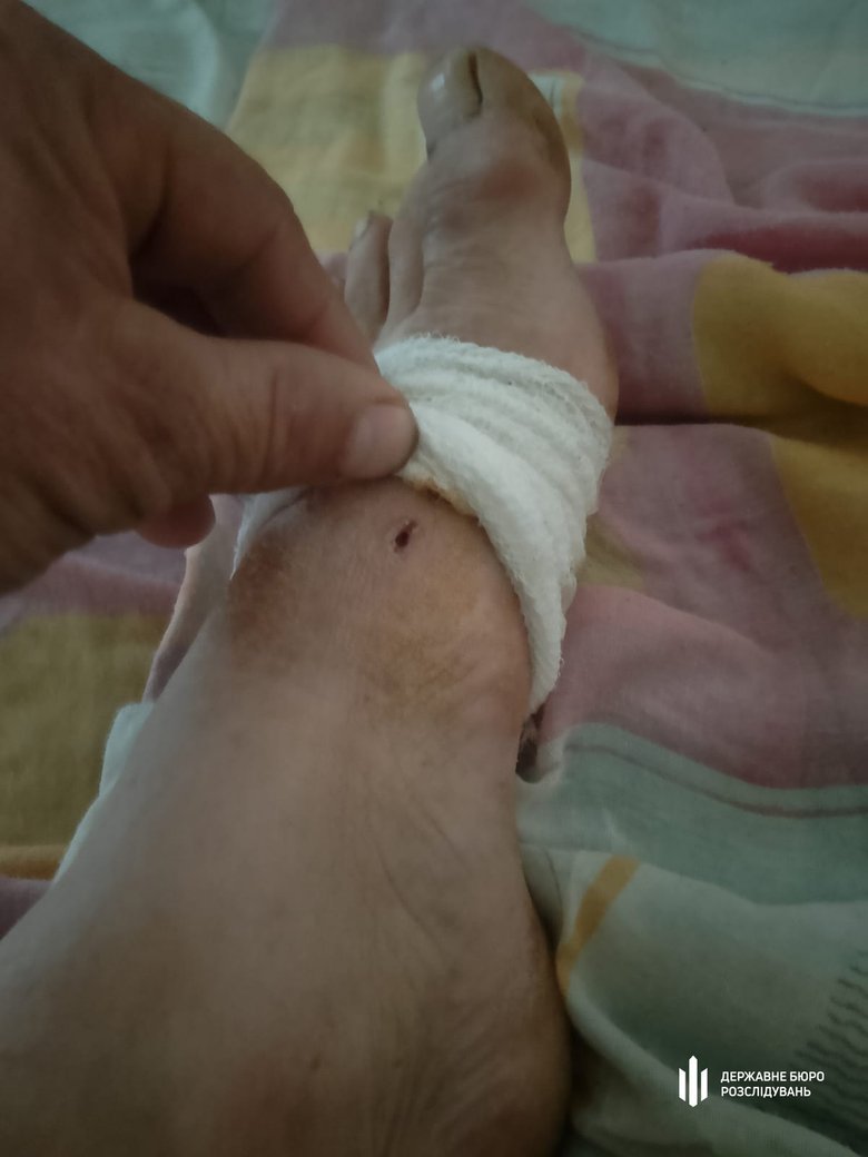 На Сумщині заступника командира батальйону підозрюють у катуванні солдатів