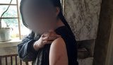 Хотіла "перевиховати": на Луганщині мати посадила на ланцюг 14-річну дочку, дівчина в лікарні. ФОТОрепортаж