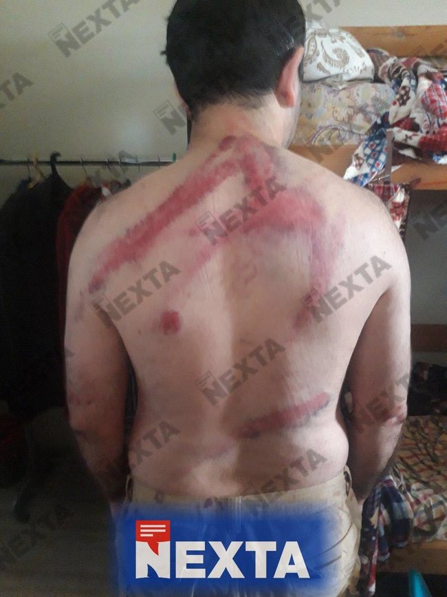 Зверства белорусского ОМОНа: жуткие кадры пыток задержанных 04