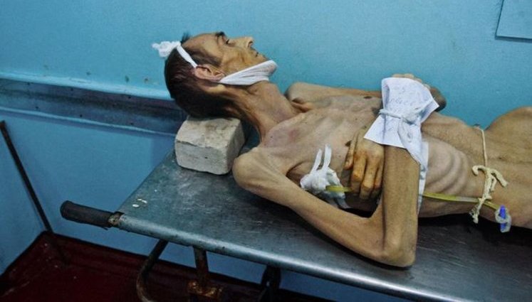 Нечеловеческие условия лечения и ни грамма надежды в глазах больных туберкулезом - украинские реалии. ФОТОрепортаж