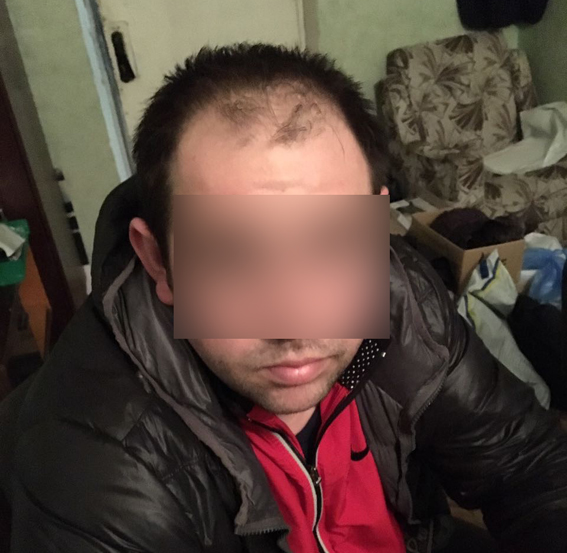 В гараже на Киевщине изъяты наркотики и пистолеты 02 В гараже на Киевщине изъяты наркотики и пистолеты 02