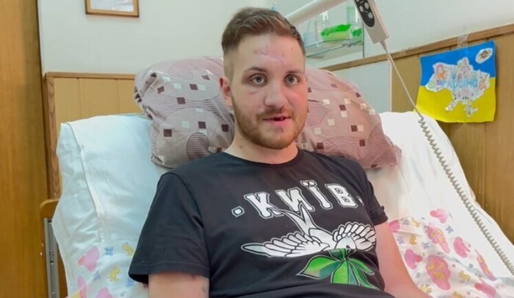 Воин Олег Симороз, подорвавшийся на противотанковой мине и потерявший обе ноги, показал фото через 3 месяца реабилитации. ФОТО
