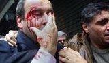Министру транспорта возле входа в парламент разбили лицо. ФОТОрепортаж